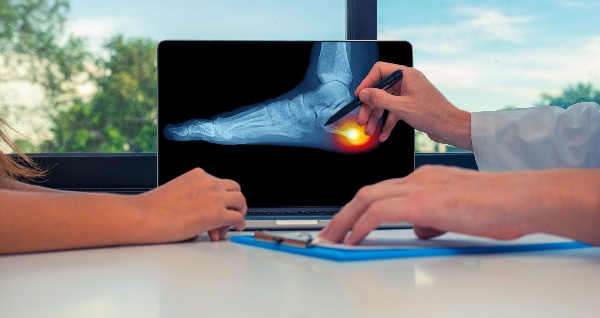Heel Pain